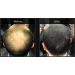 Hair Building Fibers - Light Brown Hair Loss Concealer | Thinning Hair & Volume Boost for Men & Women | 12 Day Supply - Buy Online on GoSupps.com