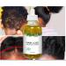 Fast Hair Growth Serum | Prevent Hair Loss & Thinning | Targets Alopecia & Hairline Issues | Postpartum & Seasonal Care Oil - Buy Online on GoSupps.com