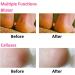 MICPANG Gel Heel Protectors for Plantar Fasciitis & Cracked Heel - Moisturizing Cushion Pads for Women and Men - Buy Online on GoSupps.com