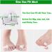 Gel Toe Separators for Bunions & Overlapping Toes - 8 Pack Hammer Toe Straightener, Pinky Toe Spacers, Bunion Corrector & Relief - White - Buy Online on GoSupps.com