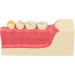 High Simulation Decomposition Model of Posterior Teeth 2x Magnification Educational Aid for Dental Studies - Buy Online on GoSupps.com