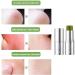 Bosuya Anti-Itch Stick for Mosquitoes & Baimiss Soothing Balm - Bug Bite Relief for All Skin Types (3pcs) - Buy Online on GoSupps.com