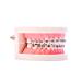 Buy Dental Orthodontic Standard Teeth Model with Metal Brackets & Wires - International Shipping Available - Buy Online on GoSupps.com