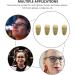 Operitacx Metal Frame Glasses Nose Pads - 4-Piece Golden Air Chamber for Comfort & Anti-Slip Support - Buy Online on GoSupps.com