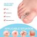 Fublazeze Toe Separator and Thumb Valgus Corrector - SEBS Material for Men and Women - Buy Online on GoSupps.com