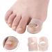 HEALLILY Ingrown Toenail Tool Toenail Corrector Patch Paronychia Toenail Treatment Tape Toenail Correction Sticker Paronychia Recover Foot Care Tool 3 Pairs - Buy Online on GoSupps.com