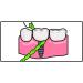 I Dontix Brace X-Floss Green - Easy-to-Use Dental Floss for Efficient Cleaning - Buy Online on GoSupps.com