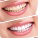 Arinda 14/7Pcs Gel Teeth Whitening Strips Kit for White Teeth Veneers - Oral Hygiene Care - Buy Online on GoSupps.com
