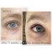 XXL Eyelash Serum & Eyebrow Serum | Quick Growth Booster for Longer Denser Lashes | Vegan Formula Proven Results in 4 Weeks - Buy Online on GoSupps.com