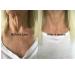 Skin Remide 2 Silicone-Fold Pads | Anti-Wrinkle Treatment | Reusable Patches for Neck Line Smoothing - Buy Online on GoSupps.com