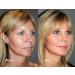Phytoceramides Rice Based with Biotin Anti Aging Supplement - 2 Pack, 120 Capsules, 40mg - Gluten Free - Buy Online on GoSupps.com