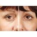 Rox Flawless Eyes by RX | Premium Eye Care for Radiant Skin | Shop Internationally Now - Buy Online on GoSupps.com