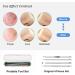 4PCS Blackhead Remover Tool Set for Acne, Comedone, Pimples, Spot, and Zit Extraction - Buy Online on GoSupps.com