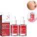 2Pcs Dark Spot Correcting Serum 10% Niacinamide+ 4% Tranexamic Acid Serum Ceramide Hyaluronic Acid Vitamin B12 natural color for Sensitive skin Fragrance-Free For Women Skin Care Serum 30ml/1fl.oz