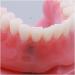 Fhuili Teeth Model for Education | Dental Implant Repair & Communication | Red Dentition Simulation Tool - Buy Online on GoSupps.com