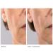 Michael Todd Beauty Sonicsmooth Replacement Kit - 7 Safety Edges for At-Home Dermaplaning - Buy Online on GoSupps.com