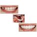 Buy 2 Pairs of Cosmetic Dentures - Instant Veneers & Temporary Teeth for Perfect Smile | Comfortable Fit - Buy Online on GoSupps.com