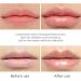 Vitamin E Lip Plumping Serum | Hyaluronic Lip Plumper for Instant Hydration & Wrinkle Relief (5pcs) - Buy Online on GoSupps.com
