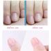 3-Piece Stainless Steel Cuticle Trimmer Set for Fingernails, Toenails, and Dead Skin - Buy Online on GoSupps.com