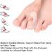 10 Pieces Pinky Toe Spacers - Cushions for Overlapping Toes | Comfort & Relief for Women & Men - Buy Online on GoSupps.com
