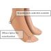 Buy Assistica Medical Compression Stockings 23-32 mmHg - Open Toe Support Stockings for Men & Women - Silicone Tape - Large Beige (158-170 cm) - Buy Online on GoSupps.com
