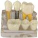 4x Dental Implant Teeth Model with Removable Crown - Crown & Bridge Dentist Training Tool for Patient Analysis | International Shipping - Buy Online on GoSupps.com