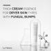 La Theorie Dual Effect Cream Essence for Troubled Skin - Fungal & Bump Relief Fatty Acid Free 1.35 Fl Oz - International Shipping Available - Buy Online on GoSupps.com