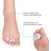 Hammer Toe Support: Straightener Spacers for Crooked Toes - Toe Separators for Hallux Valgus & Overlap - Foot Toe Protector - Buy Online on GoSupps.com