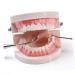 Ultechnovo Dental Model Set - Educational Children's Tooth Model | Plastic Denture Model for Kids | Ideal for Schools & Dental Training - Buy Online on GoSupps.com