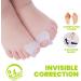 Kids Bunion Corrector & Toe Separator Kit - 6 PCS Set for Overlapping Hallux Valgus (3-6 Years Old) - Buy Online on GoSupps.com