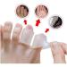 TOSSPER 10Pcs Silicone Little Toe Tube - Blister & Bunion Protection Gel Sleeves for Comfort & Relief - Buy Online on GoSupps.com