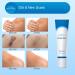 Aroamas Scar Silicone Gel 30g - Soften & Flatten Surgical Scars, Keloids, Stretch Marks - Medical-Grade Clinically Proven Formula - Buy Online on GoSupps.com