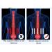 Limit-Less Lower Lumbar Support Brace for Herniated Disc & Sciatica Relief - Breathable Comfort for Men & Women (Black Large) - International Shipping Available - Buy Online on GoSupps.com