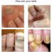 7 Days Nail Growth and Strengthening Serum 1/2/3/5 bottles Nail Strengthener and Growth Serum (5 bottles) - Buy Online on GoSupps.com