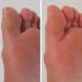 Mediashop Pedivac - Rechargeable Electric Corn Remover for Foot Care | Includes Manic Door Set & 2 Attachments (Rough & Fine) - International Shipping Available - Buy Online on GoSupps.com