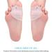 Gel Toe Separator Set with Forefoot Cushions for Hallux Valgus Correction - Women & Men | Bunion Corrector & Hammer Toe Straightener - Buy Online on GoSupps.com
