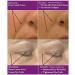 Raw Biology Organic Liquid Facelift with Vitamin C, Retinol & Hyaluronic Acid 1 Fl Oz (Pack of 3) - Buy Online on GoSupps.com