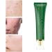 acne removal cream Acne Scar Removal Gel Face Body Marks Skin Repair Cream Acne Treatment Essence 30g - Buy Online on GoSupps.com