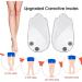 Orthopedic O/X Type Leg Corrector Insoles - 3 Pairs Silicone Heel Inserts for Foot Alignment & Pain Relief - Ideal for Knock Knees & Bow Legs - Buy Online on GoSupps.com
