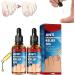 (100% Effective) KYOSK 10ml German Anti Paronychia Relief Oil Anti Paronychia Relief Oil Treatment Repair Paronychia Improve Toenail Health (2pcs)