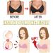 Breast Enlargement Plaster - Enhance & Firm Breasts | 50 pcs Breast Enhancement Patch for Sagging & Firming - Buy Online on GoSupps.com