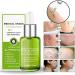 Proregen Medical Grade Scar Removal Spray - Advanced Serum for All Types of Scars (1PCS) - Buy Online on GoSupps.com
