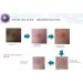Buy Acne Seboderm Solution - Anti Sebum Treatment for Blemish-Prone Skin | Pore Shrinking Care Worldwide Shipping - Buy Online on GoSupps.com