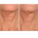SiO Beauty Plunging Neckline - Overnight Silicone Smoothing Patches for Neck & Chest | Reusable SkinPad & Necklift - Shop Now - Buy Online on GoSupps.com