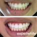 44 Teeth Whitening Gel Refills - USA Made Carbamide Peroxide - 4 Syringes (3 cc each) for Custom Dental Trays - Fast International Shipping - Buy Online on GoSupps.com