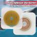 LotFancy 10 Pcs Skin Barrier with Non-Woven Border for Two-Piece Drainable Pouch | Ostomy Wafers for Colostomy & Ileostomy Stoma Care | Cut-to-Fit - Buy Online on GoSupps.com