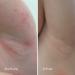 KAMEDIS Eczema Therapy Cream for Atopic Dermatitis, Sensitive & Irritated Skin 5.07 fl. Oz - Buy Online on GoSupps.com