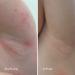 KAMEDIS Eczema Therapy Soothing Body Cream - Clinically Proven Itchy Relief for Dry & Sensitive Skin | Botanicals-Based & Dermatologist Recommended | Paraben-Free 2pk - Buy Online on GoSupps.com