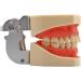 Ernzi Dental Training Model for Demonstration - Adult Teeth with Removable Screwdrivers | International Shipping Available - Buy Online on GoSupps.com