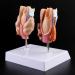 Thyroid Pathology Model Thyroid Cancer Model Throat Model Thyroid Disease Model for Medical Teaching Toys - Buy Online on GoSupps.com